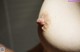 A close up of a woman's breast with a small lump on it.